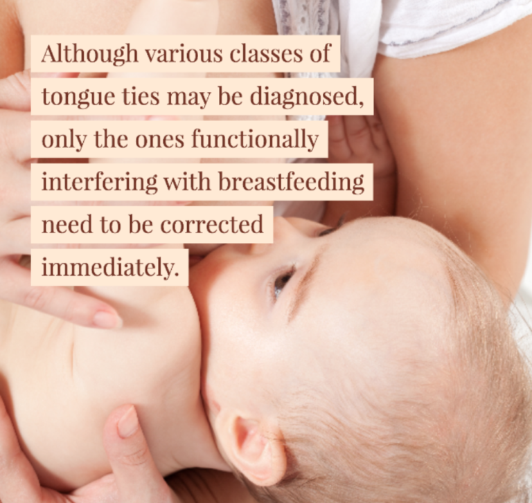 What Does A Tongue Tie Look Like? Dr. Chelsea Pinto Los Angeles